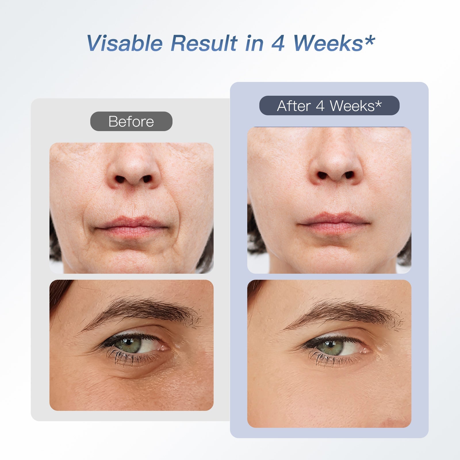 IBORRIA Aura2 Pro RF Anti-aging Beauty Device