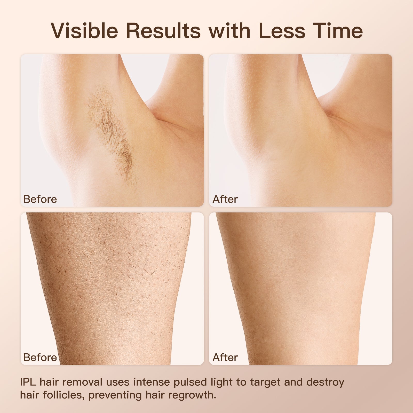 Iborria T4 Mini IPL Hair Removal